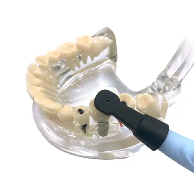 Localizador de implantes dentários detetor inteligente de implantes sensor rotativo tridimensional