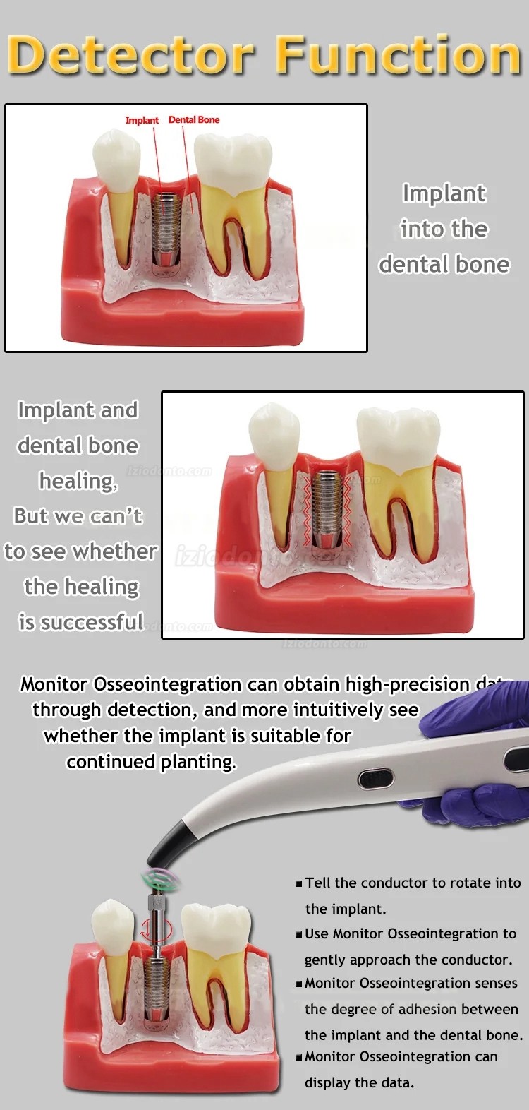 Medidor dentário portátil da estabilidade do implante do monitor da estabilidade do implante de ISQ