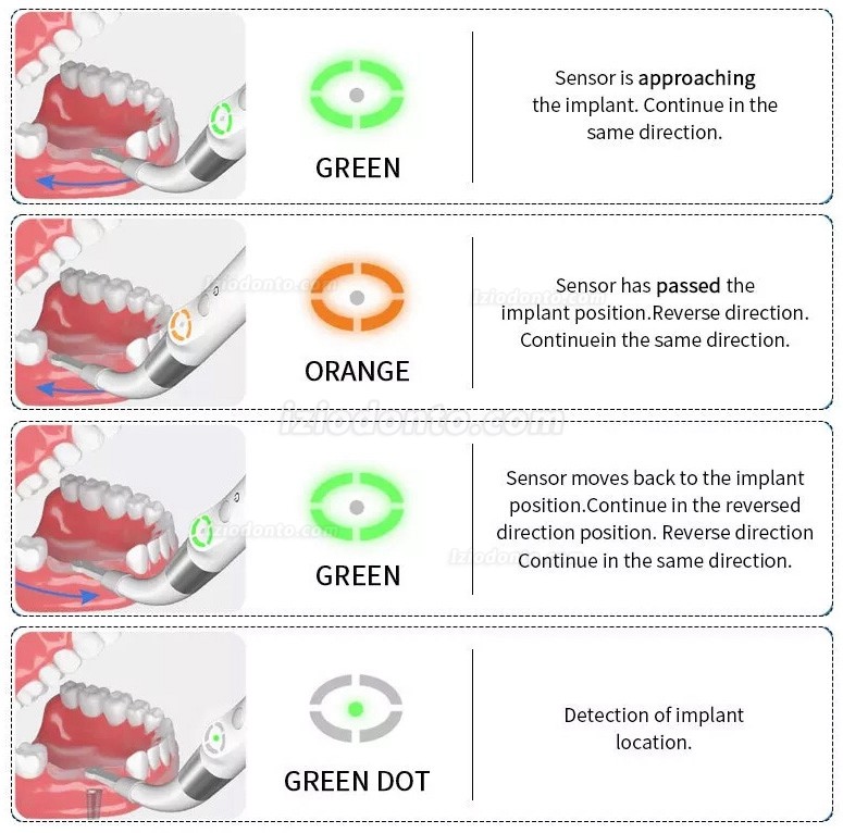 YAHOPE iD1 Detetor de implantes dentários localizador de pilares de implantes sensor rotativo de 360°